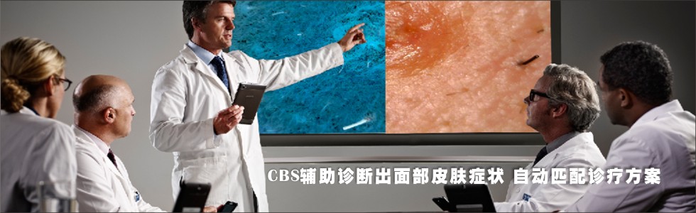 CBSƤwzy(c)\ϵy(tng)o\沿YԄ(dng)ƥ\